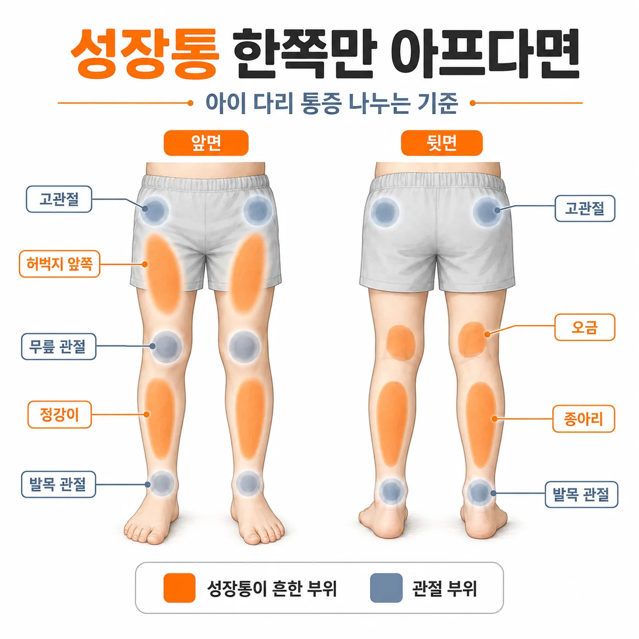 아이 다리에서 성장통이 흔한 부위와 관절 부위를 표시한 그림