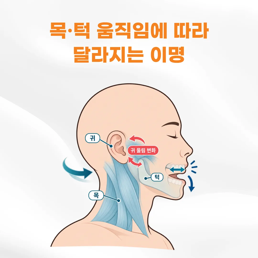 목 옆과 턱 주변 근육의 위치를 귀와 함께 표시해 고개와 턱 움직임이 귀 울림의 크기를 바꿀 수 있음을 보여 주는 개념도