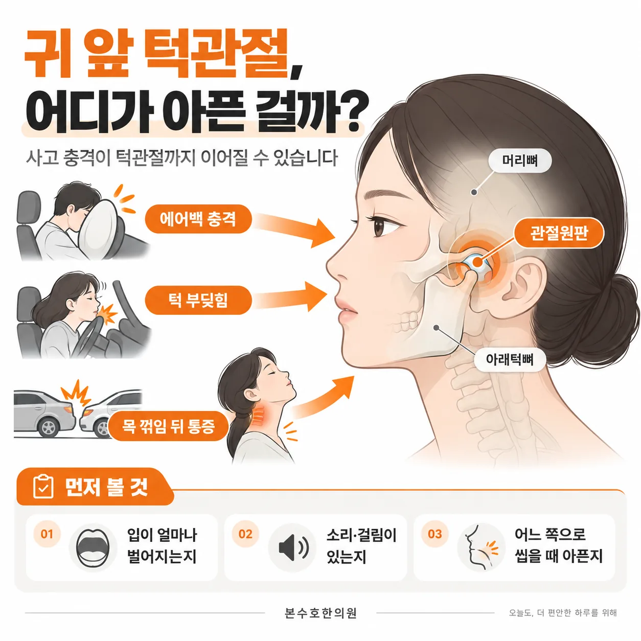 귀 바로 앞에 있는 턱관절의 위치와 아래턱뼈·머리뼈·관절원판이 놓인 구조를 표시한 개념도